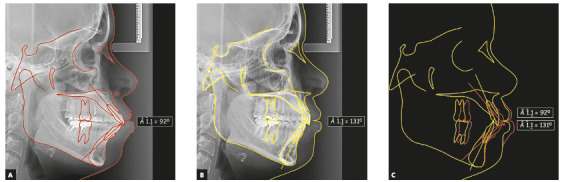 Figure 41