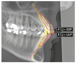 Figure 28