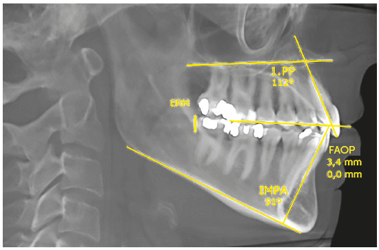 Figure 25