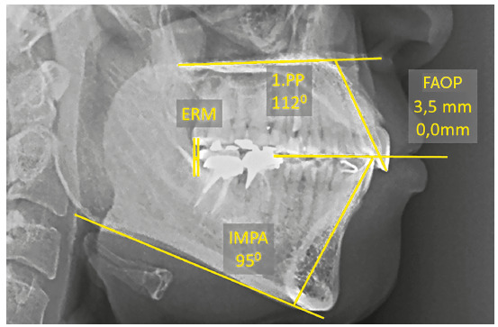 Figure 38