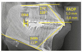 Figure 33