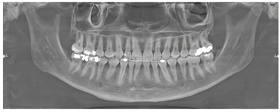 Figure 27