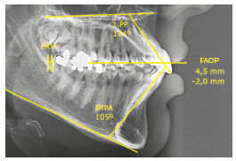 Figure 19