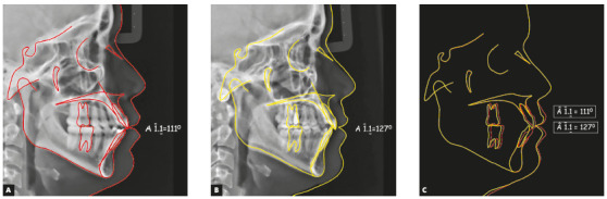 Figure 14