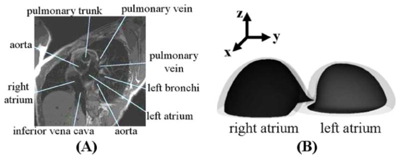 Fig. 12