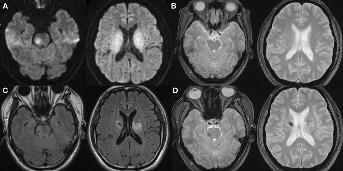 Fig. 2