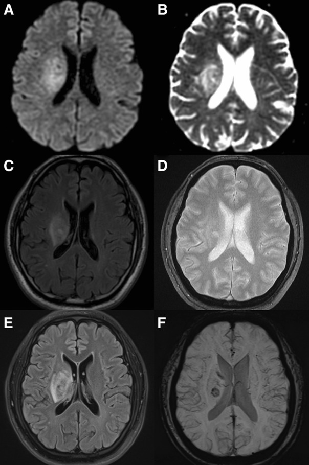 Fig. 1