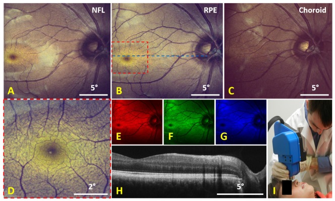 Fig. 7