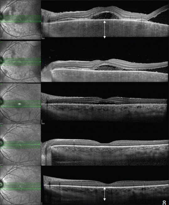 Figure 11