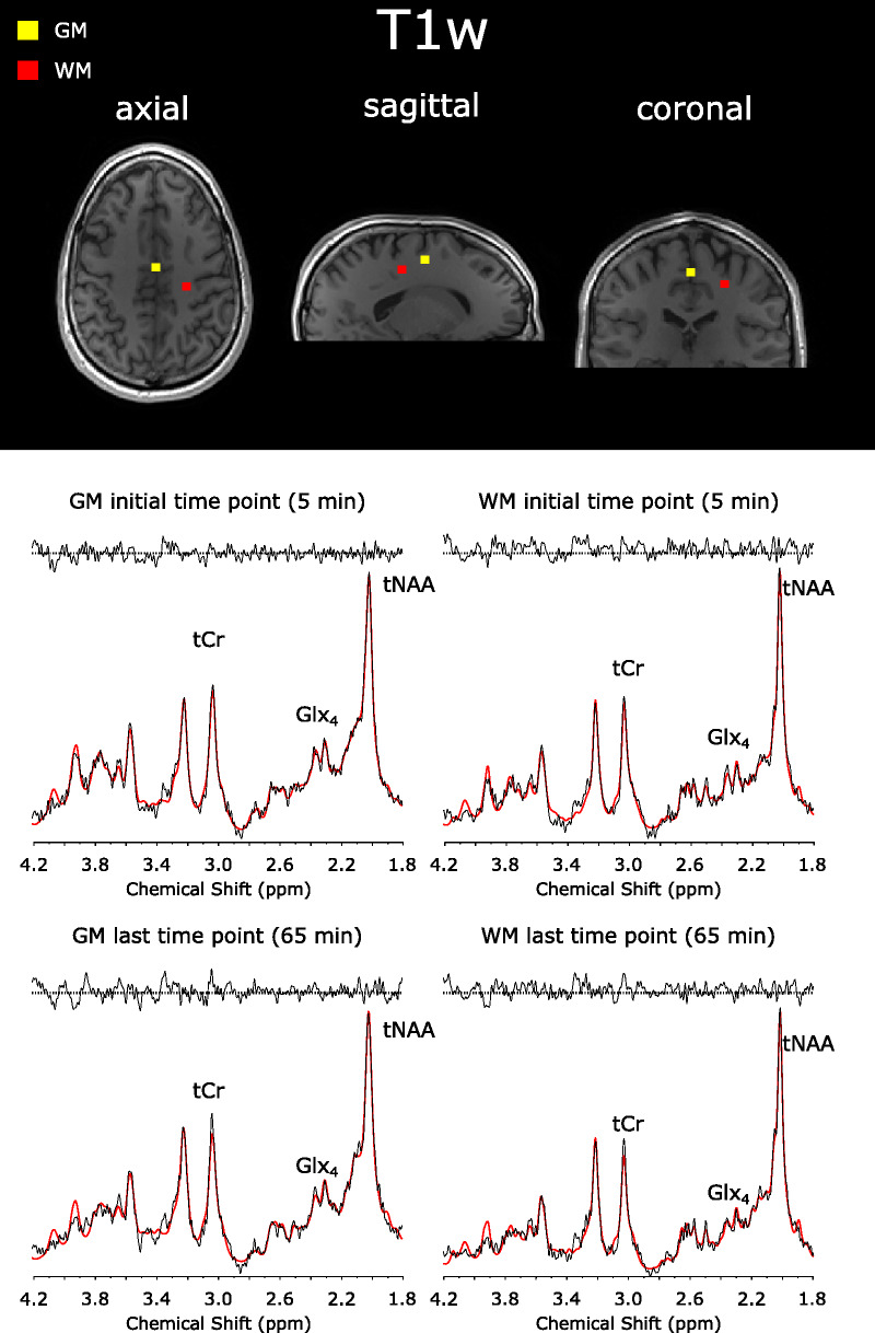 FIGURE 3