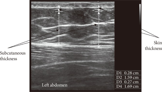 Fig. 1