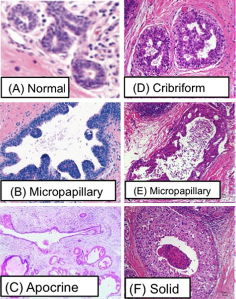 Fig. 13