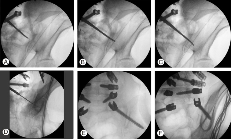 Fig. 2.