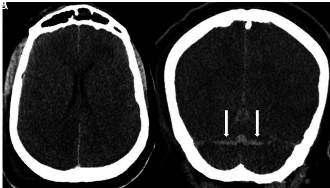 FIG 2.