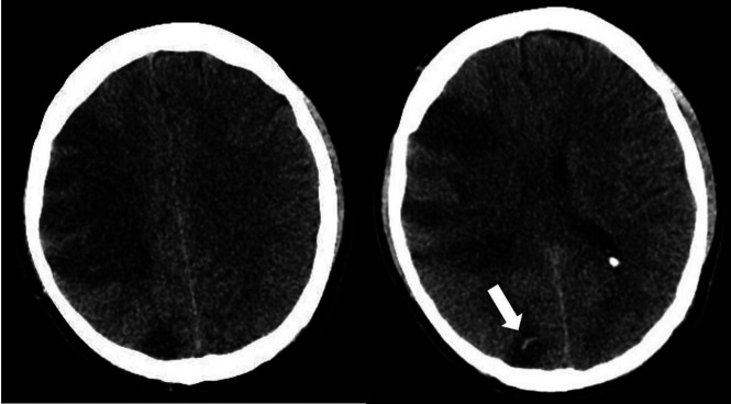 FIG 3.