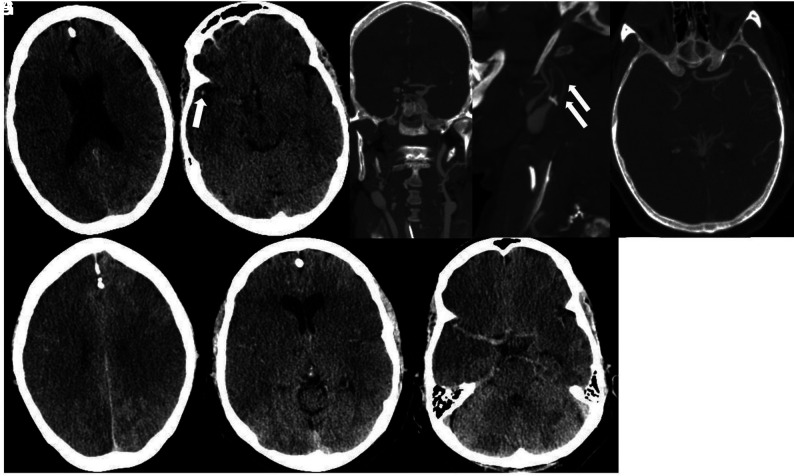 FIG 10.