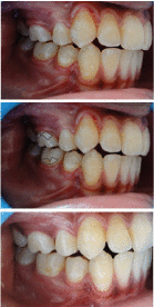 [Table/Fig-2a-c]: