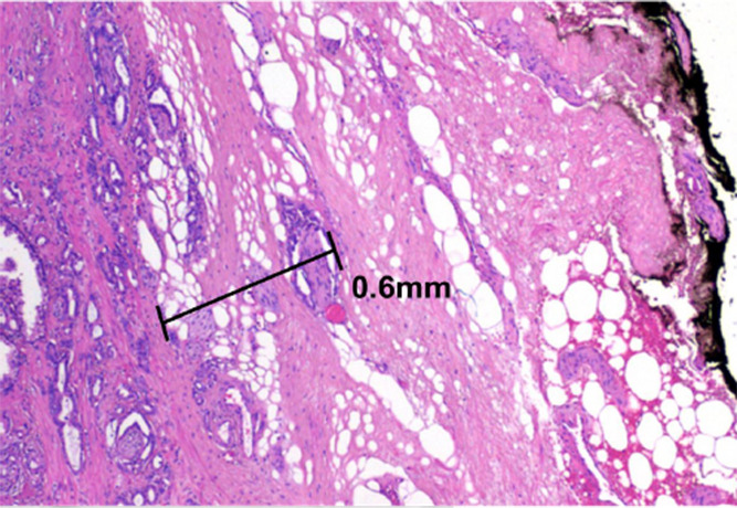 Figure 7c: