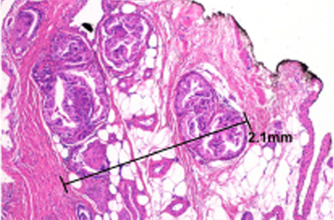 Figure 6c: