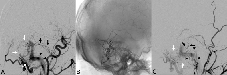 Fig 2.