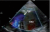 Figure 2c