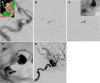 Fig. 4
