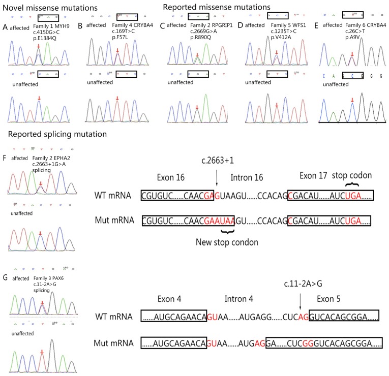 Novel mutations associated with autosomal-dominant congenital cataract ...