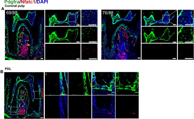 Figure 4—figure supplement 2.