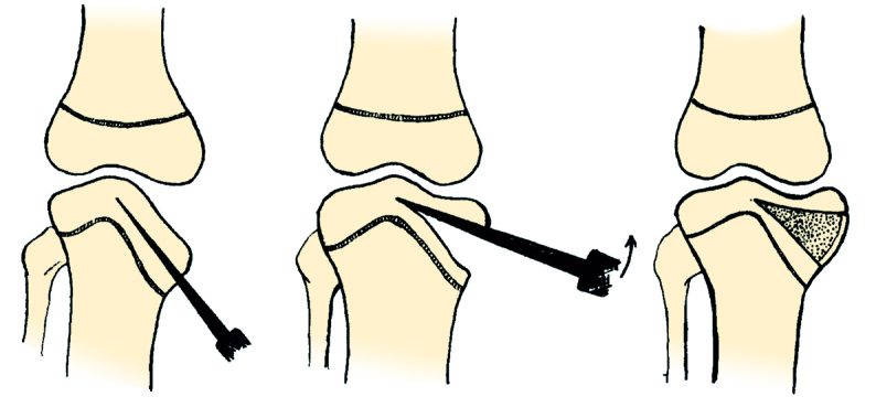 Figure 1 c.