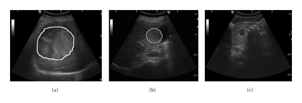 Figure 13