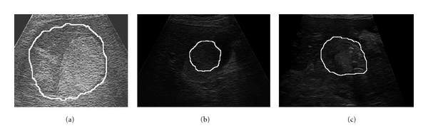 Figure 15