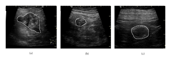 Figure 14