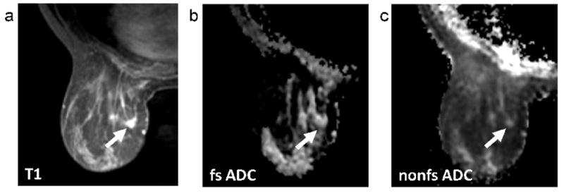 FIG. 5