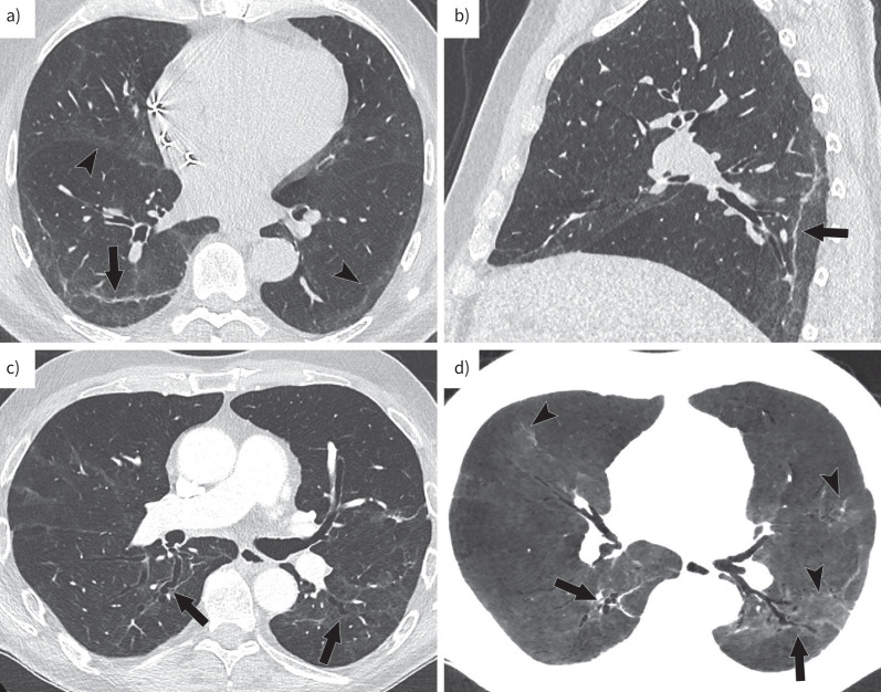 FIGURE 1