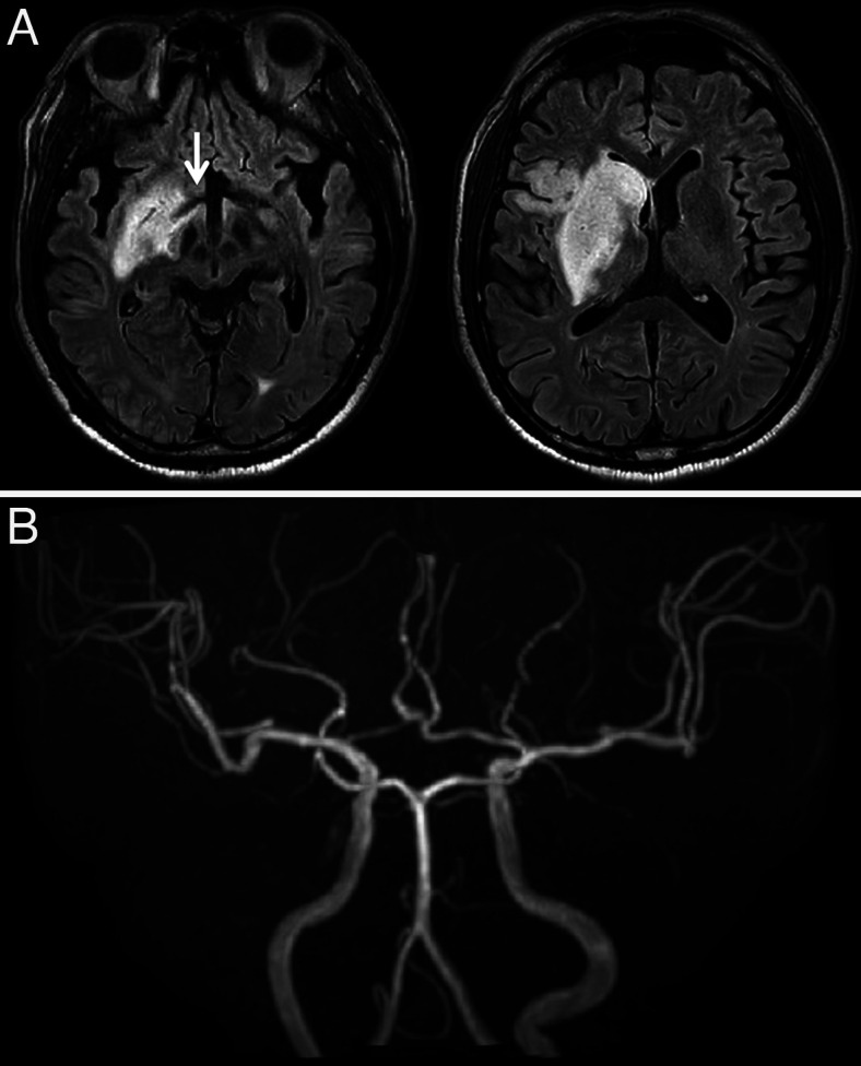 FIG. 5.