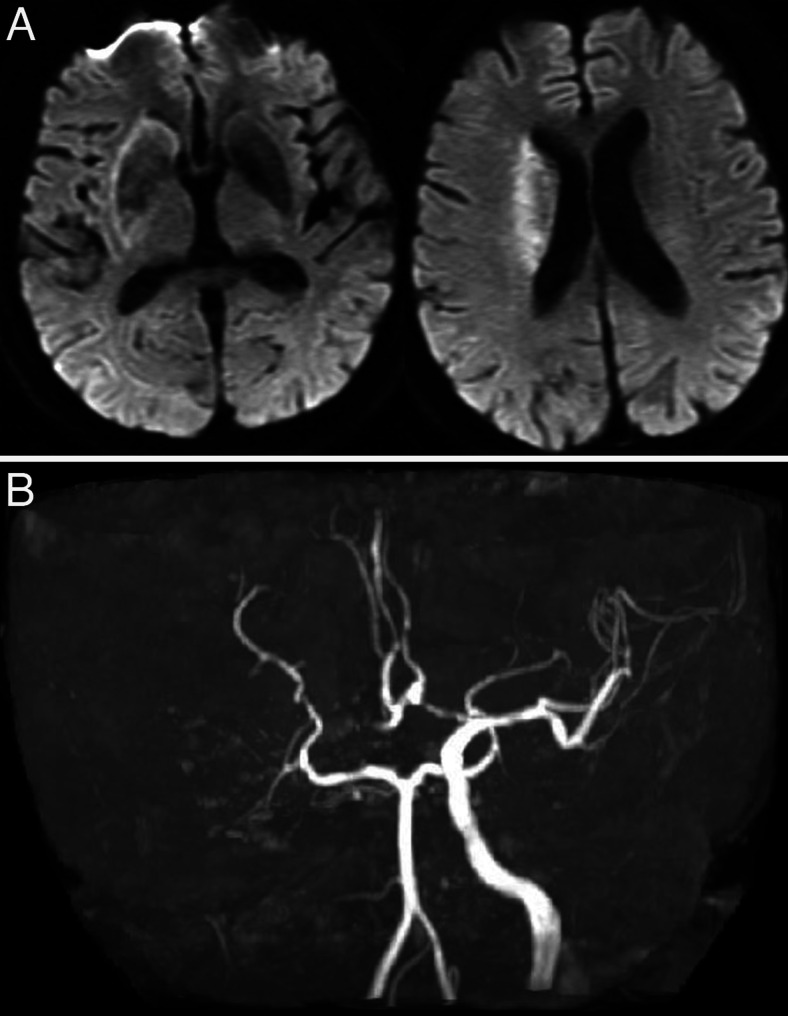 FIG. 1.