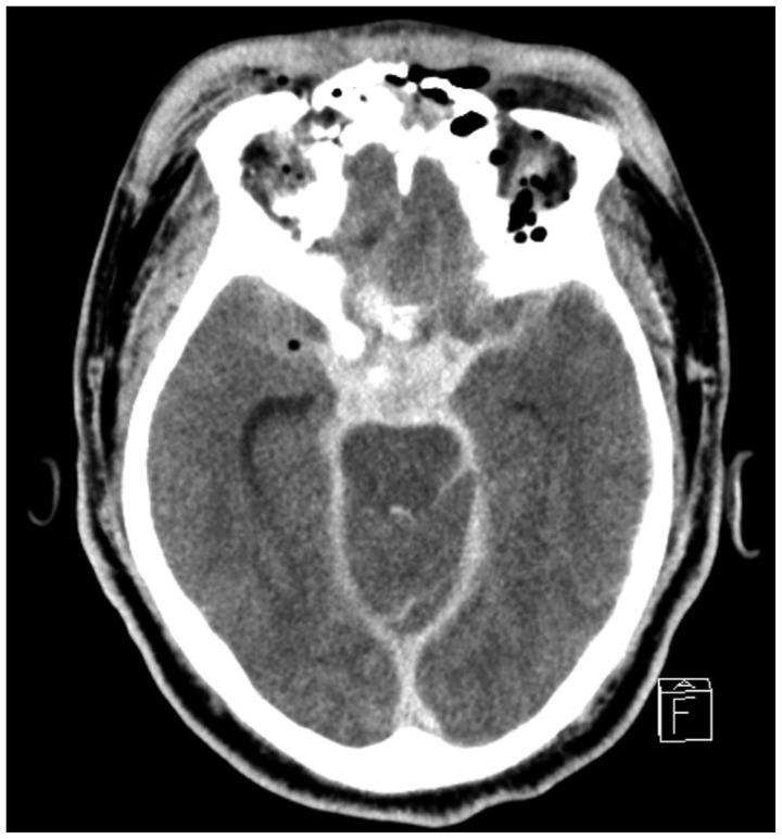 Fig. 3