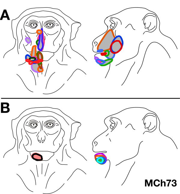 Fig. 10