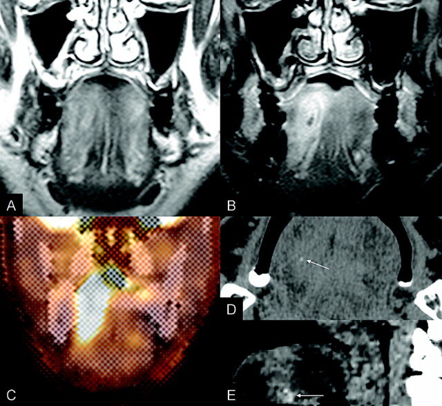 Fig 2.