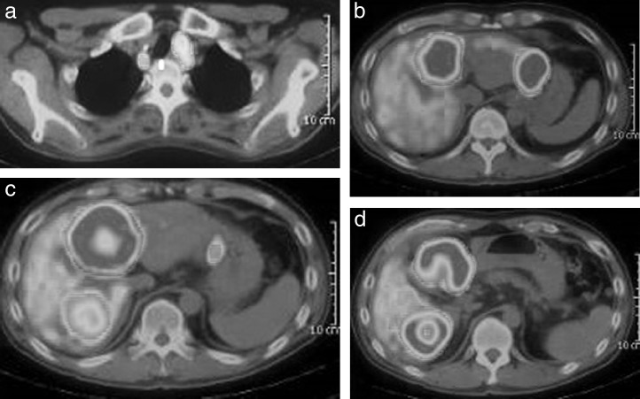 Fig. 3