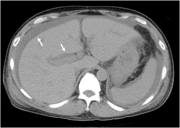 Fig. 1a