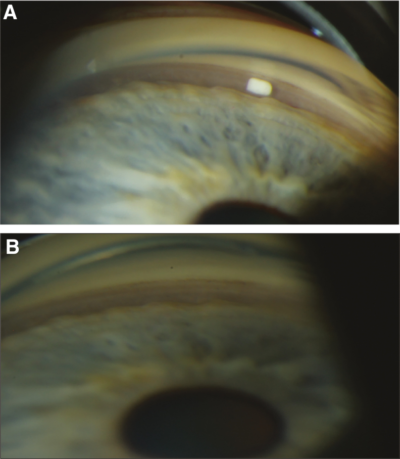 FIG. 11.