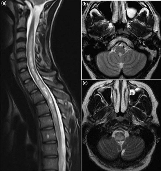 Fig 2.