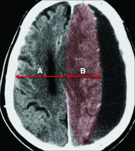 FIG. 4.