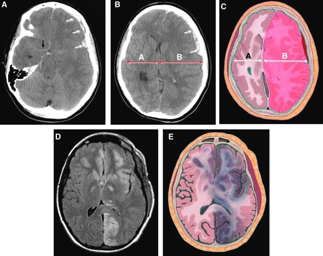 FIG. 1.