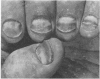 444