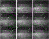 FIG. 25.4