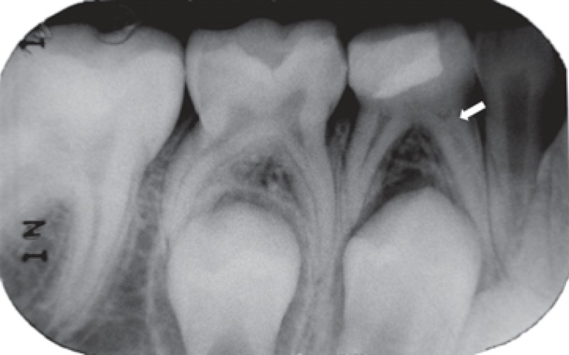 FIGURE 1C