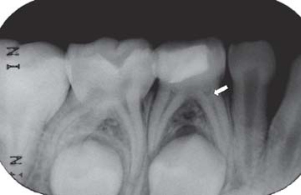 FIGURE 1B