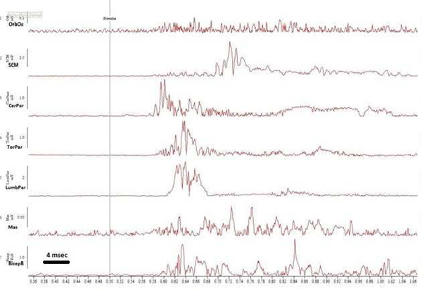 Figure 2a.